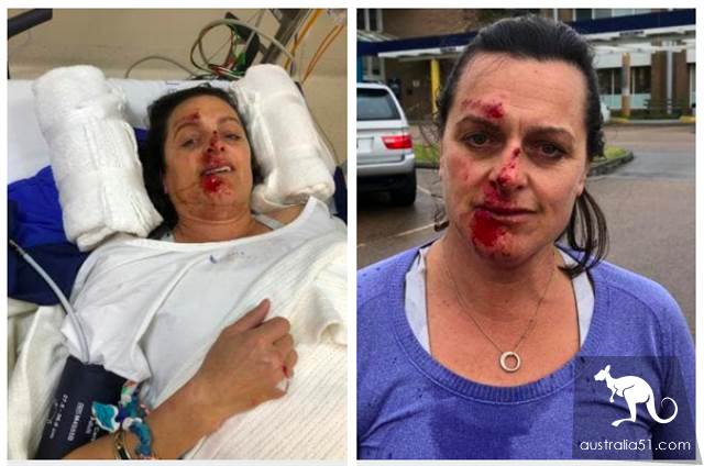 The Virginia woman was knocked out by kangaroos in the morning and woke up with blood on her face