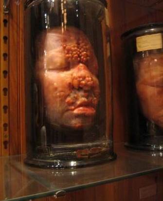 The Matt Museum in Philadelphia, USA