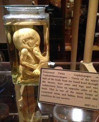 The Matt Museum in Philadelphia, USA