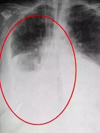 太恐怖!澳洲大妈挣扎2小时,最终惨死在医院!真相令人发指,这是在杀人啊...