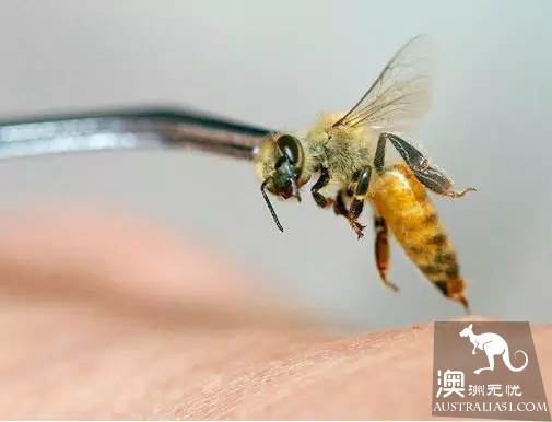太毒了！澳洲男修剪草坪时，突然浑身肿胀命丧黄泉！我们后院里竟暗藏澳洲第一杀手！