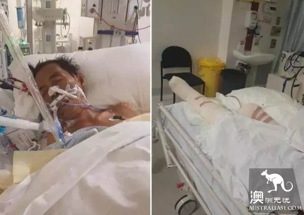 太毒了！澳洲男修剪草坪时，突然浑身肿胀命丧黄泉！我们后院里竟暗藏澳洲第一杀手！