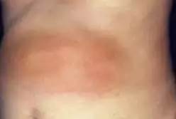 太毒了！澳洲男修剪草坪时，突然浑身肿胀命丧黄泉！我们后院里竟暗藏澳洲第一杀手！