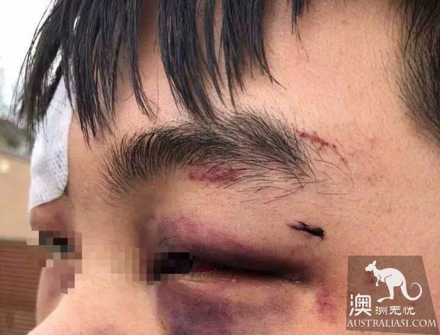 Burst! Chinese students who have been beaten violently by local people are covered in blood because they refuse to give cigarettes.