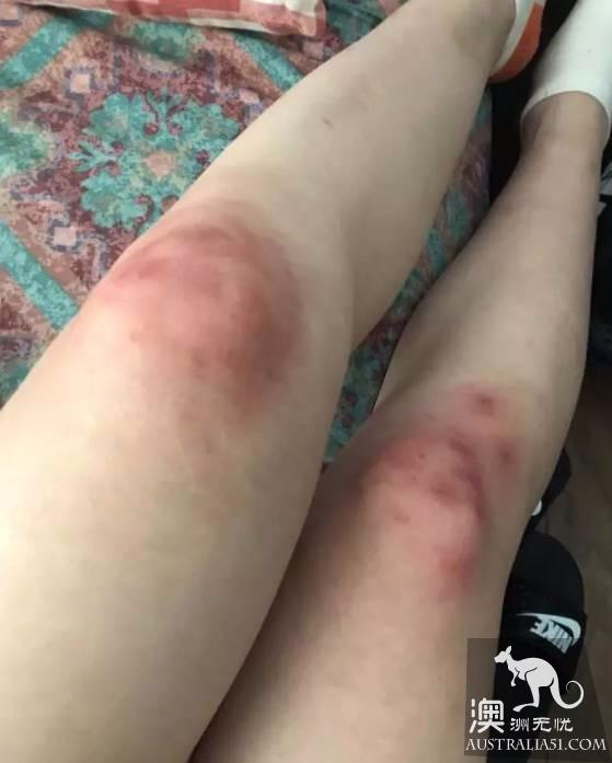 Burst! Chinese students who have been beaten violently by local people are covered in blood because they refuse to give cigarettes.