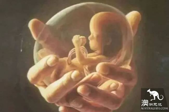 4000 international students have abortions every year!