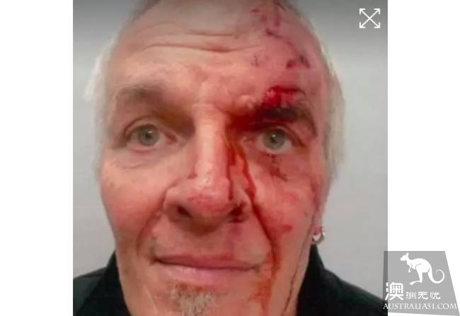 The deaf driver of Uber was beaten by three men. Police appealed to people familiar with the situation to provide clues.