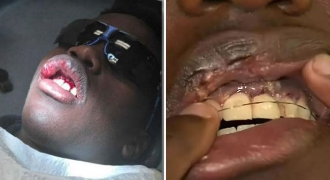 Two private school football matches in Victoria are now racist! Australian teenager beating players