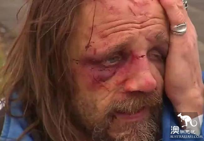 There's been a violent burglary in Adelaide! Even the disabled!