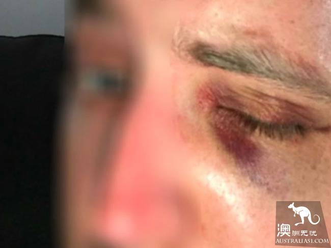 墨尔本警察遭非裔青年殴打，称对司法系统超失望!