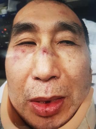 Another Australian Chinese shopkeeper was armed robbery, gun butts hit the head wound appalling! Chinese merchants targeted? One wound a month!