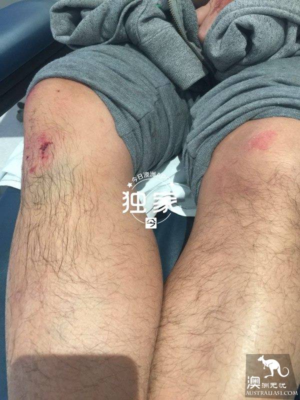 “他们叫嚣捅死我们、强奸我，还想烧店！”卧龙岗华人及留学生成袭击目标，频遭殴抢，多人受伤！