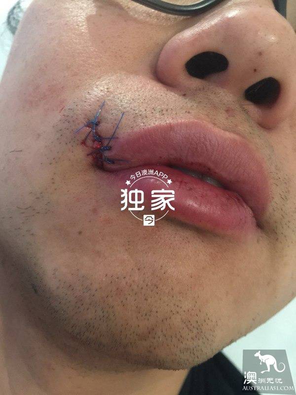 “他们叫嚣捅死我们、强奸我，还想烧店！”卧龙岗华人及留学生成袭击目标，频遭殴抢，多人受伤！