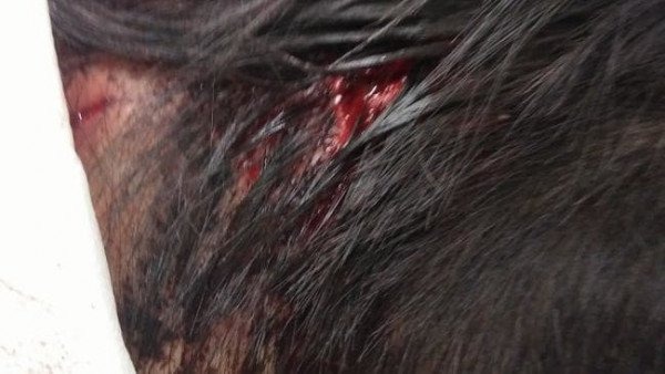 Another Australian Chinese shopkeeper was armed robbery, gun butts hit the head wound appalling! Chinese merchants targeted? One wound a month!