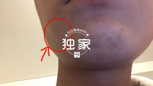 “他们叫嚣捅死我们、强奸我，还想烧店！”卧龙岗华人及留学生成袭击目标，频遭殴抢，多人受伤！