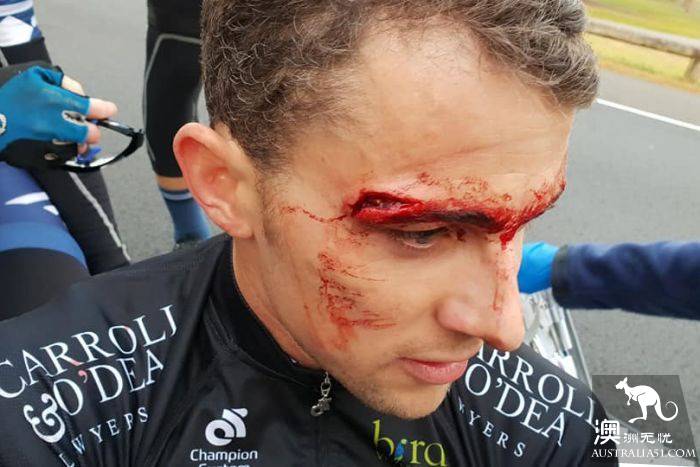 The cyclist was hit by a fracture and needed surgery. Sydney van hit and ran after the accident.