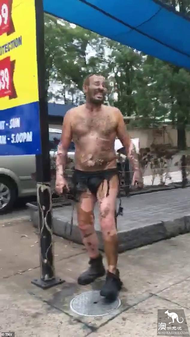 Sydney gas station appears to burn the man, burning all over the body is only underwea