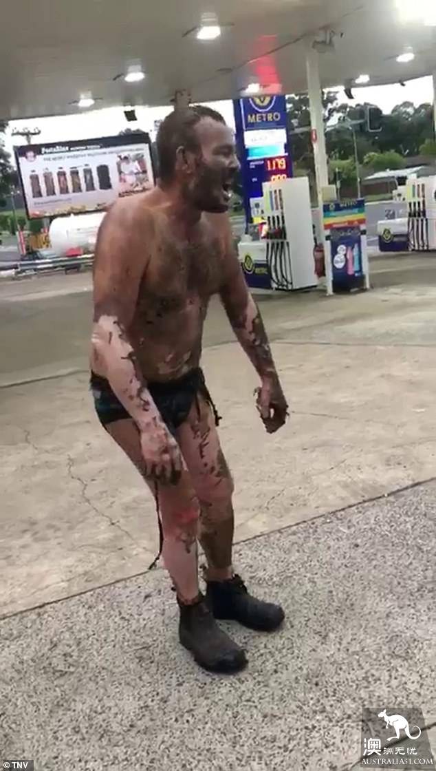 Sydney gas station appears to burn the man, burning all over the body is only underwea